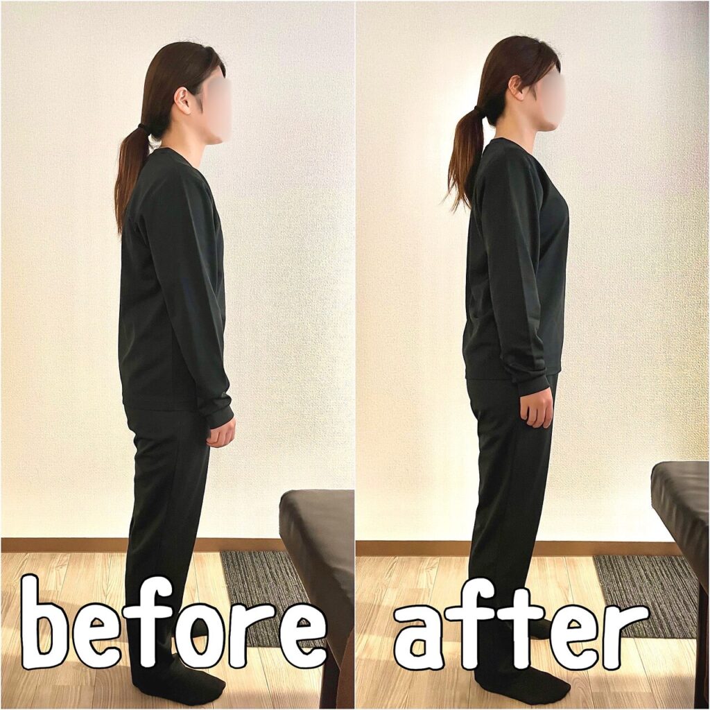 猫背の姿勢が気になっていた30代女性の姿勢確認事例